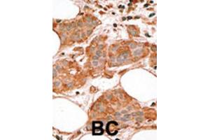 Immunohistochemistry (IHC) image for anti-BCL2-Like 14 (Apoptosis Facilitator) (BCL2L14) (BH3 Domain) antibody (ABIN2997105) (BCL2L14 抗体  (BH3 Domain))