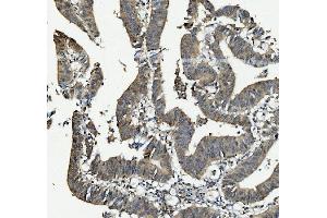 IHC analysis of ANAPC2 using anti-ANAPC2 antibody (ABIN7601930).