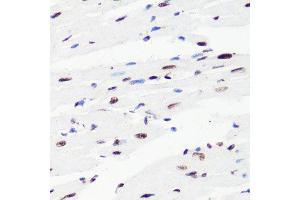 Immunohistochemistry (Paraffin-embedded Sections) (IHC (p)) image for anti-Histone 3 (H3) (H3K36me2) antibody (ABIN3016036)