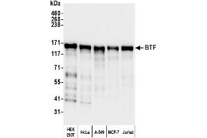 Western Blotting (WB) image for anti-BCL2-Associated Transcription Factor 1 (BCLAF1) (AA 150-200) antibody (ABIN7454651)