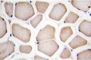Image no. 1 for anti-CASP8 and FADD-Like Apoptosis Regulator (CFLAR) antibody (ABIN272307) (FLIP 抗体)