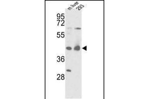 Western Blotting (WB) image for anti-Isocitrate Dehydrogenase 1 (NADP+), Soluble (IDH1) (AA 63-90), (N-Term) antibody (ABIN391659)