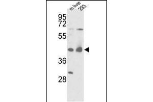 Western blot analysis of IDH1 Antibody (N-term) (ABIN391659 and ABIN2841570) in mouse liver tissue and 293 cell line lysates (35 μg/lane). (IDH1 抗体  (N-Term))