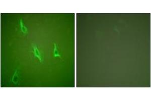 Immunofluorescence analysis of HeLa cells, using Caspase 10 Antibody. (Caspase 10 抗体  (AA 430-479))