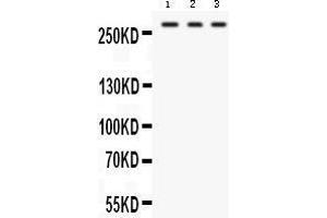 Western blot analysis of FASN expression in HEPG2 whole cell lysates (lane 1), U87 whole cell lysates (lane 2) and RAJI whole cell lysates (lane 3). (Fatty Acid Synthase 抗体  (AA 1-226))