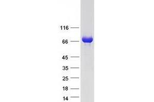 Western Blotting (WB) image for Kelch-like protein 41 (KLHL41) protein (Myc-DYKDDDDK Tag) (ABIN2723997)