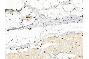Phospho-PFKFB3 (Ser461) Antibody at 1/100 staining Rat skin tissue by IHC-P.
