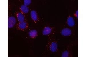 IF analysis of SNX6 using anti-SNX6 antibody (ABIN7599362). (SNX6 抗体  (AA 1-406))