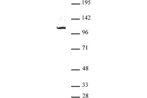 GLI1 antibody (pAb) tested by Western blot. (GLI1 抗体  (C-Term))
