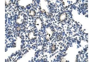 PCBP2 antibody was used for immunohistochemistry at a concentration of 4-8 ug/ml to stain Alveolar cells (arrows) in Human Lung. (PCBP2 抗体)
