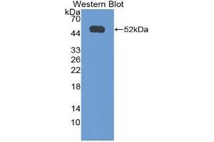 Western blot analysis of the recombinant protein. (IFNGR1 抗体  (AA 23-253))