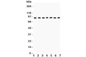 Western blot testing of MSK1 antibody and Lane 1:  human placenta;  2: rat brain;  3: (h) Jurkat;  4: (h) HeLa;  5: (h) PANC;  6: (h) A549;  7: (h) HEPG2. (MSK1 抗体  (AA 540-665))