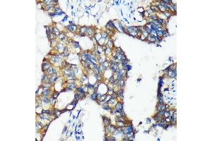 Immunohistochemistry (IHC) image for anti-Chromosome 18 Open Reading Frame 8 (C18orf8) (AA 1-300) antibody (ABIN7266379)