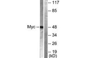 Western blot analysis of extracts from HeLa cells, treated with Forskolin 40nM 30', using MYC (Ab-62) Antibody. (c-MYC 抗体  (AA 31-80))
