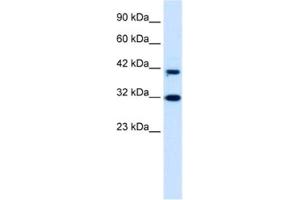 Western Blotting (WB) image for anti-D4, Zinc and Double PHD Fingers Family 1 (DPF1) antibody (ABIN2460940) (DPF1 抗体)