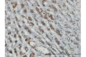 Image no. 2 for anti-RAS and EF Hand Domain Containing (RASEF) (AA 631-740) antibody (ABIN599333) (RASEF 抗体  (AA 631-740))