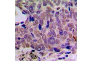 Immunohistochemistry (IHC) image for anti-cAMP Responsive Element Binding Protein 1 (CREB1) (Center) antibody (ABIN7300560)