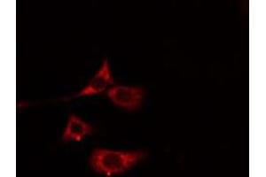 ABIN6275794 staining Hela cells by IF/ICC. (MYL7 抗体)