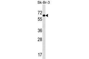 TRIP4 Antibody (Center) western blot analysis in SK-BR-3 cell line lysates (35 µg/lane). (TRIP4 抗体  (Middle Region))