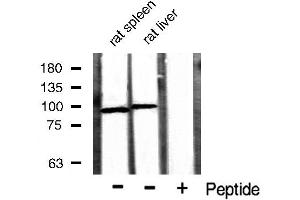 Western blot analysis of extracts of various sample,using Catenin-β antibody. (CTNNB1 抗体  (N-Term))
