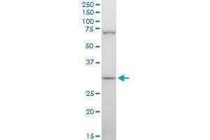 STOM polyclonal antibody (A01), Lot # 060717JCS1. (Stomatin 抗体  (AA 59-142))