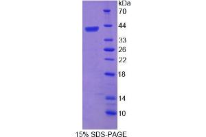 Image no. 1 for Telomeric Repeat Binding Factor 2 (TERF2) (AA 144-438) protein (His tag) (ABIN6237389) (TRF2 Protein (AA 144-438) (His tag))