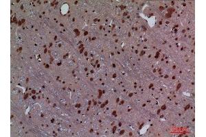Immunohistochemistry (IHC) analysis of paraffin-embedded Rat Brain, antibody was diluted at 1:100. (HOXD3 抗体  (Internal Region))