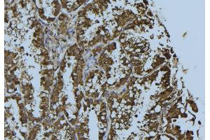 ABIN6276283 at 1/100 staining Mouse testis tissue by IHC-P. (Prohibitin 抗体  (Internal Region))