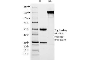 SDS-PAGE Analysis Purified pS2 Mouse Monoclonal Antibody (SPM313). (TFF1 抗体  (AA 57-84))