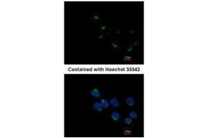 ICC/IF Image Immunofluorescence analysis of methanol-fixed A431, using GALNT6, antibody at 1:200 dilution. (GALNT6 抗体)