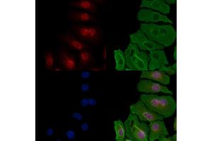 ABIN6257259 and ABIN6274296 staining Hela cells by IF/ICC.