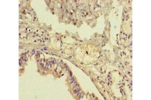 Immunohistochemistry of paraffin-embedded human lung tissue using ABIN7173257 at dilution of 1:100 (TMEM64 抗体  (AA 40-118))