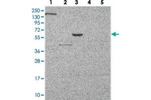 Western blot analysis of Lane 1: RT-4, Lane 2: U-251 MG, Lane 3: Human Plasma, Lane 4: Liver, Lane 5: Tonsil with MUC13 polyclonal antibody . (MUC13 抗体)