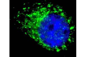 Fluorescent ige of  cells stained with G8a/b (M1LC3A/B) antibody. (MAP1LC3A/B 抗体  (cleaved))