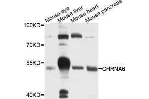 Western blot analysis of extracts of various cells, using CHRNA6 antibody. (CHRNA6 抗体)