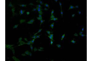 Immunofluorescence staining of MCF-7 cells with ABIN7158784 at 1:100, counter-stained with DAPI. (PPT2 抗体  (AA 28-302))