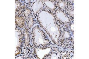 IHC analysis of SPT5/SUPT5H using anti-SPT5/SUPT5H antibody (ABIN7601985).