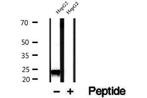 Western blot analysis of extracts of HepG2 cells, using RAB14 antibody. (RAB14 抗体  (C-Term))