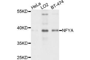 Western blot analysis of extract of various cells, using NFYA antibody. (NFYA 抗体)