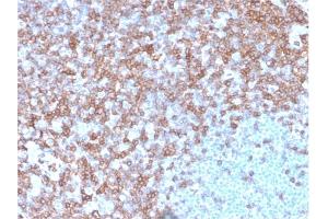 Formalin-fixed, paraffin-embedded human spleen stained with CD43 Mouse Monoclonal Antibody (SPN/3388). (CD43 抗体)