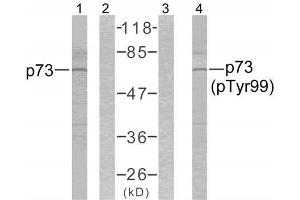 Western blot analysis of the extracts from K562 cells using p73 (Ab-99) antibody (E021075, Lane 1 and 2) and p73 (phospho-Tyr99) antibody (E011058, Lane 3 and 4). (Tumor Protein p73 抗体)
