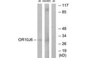 Western blot analysis of extracts from Jurkat/HuvEc cells, using OR10J6 Antibody. (OR10J6P 抗体  (AA 227-276))