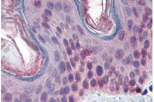 Human Skin: Formalin-Fixed, Paraffin-Embedded (FFPE) (STK16 抗体  (AA 1-306))