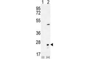 Western blot analysis of VSNL1 (arrow) using rabbit polyclonal VSNL1 Antibody (Center) . (VSNL1 抗体  (Middle Region))