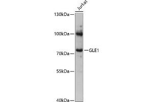 Western blot analysis of extracts of Jurkat cells, using GLE1 antibody (ABIN6131944, ABIN6141122, ABIN6141124 and ABIN6217119) at 1:3000 dilution. (GLE1 抗体  (AA 1-300))