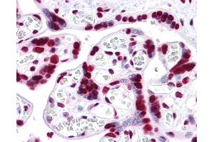 Anti-HMGB1 antibody IHC of human placenta. (HMGB1 抗体  (AA 1-216))