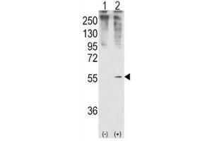Western blot analysis of GDF11 antibody and 293 cell lysate (2 ug/lane) either nontransfected (Lane 1) or transiently transfected with the GDF11 gene (2). (GDF11 抗体  (AA 32-61))
