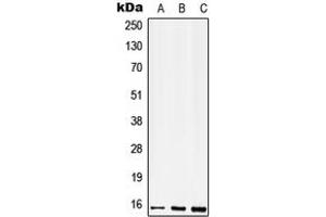 Western blot analysis of CD52 expression in THP1 (A), mouse spleen (B), H9C2 (C) whole cell lysates. (CD52 抗体  (N-Term))
