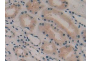 Detection of HMGCS in Human Kidney Tissue using Polyclonal Antibody to Hydroxymethylglutaryl Coenzyme A Synthase (HMGCS)