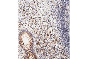 Immunohistochemical analysis of paraffin-embedded human epityphlon tissue using (ABIN1981278 and ABIN2845115) performed on the Leica® BOND RXm. (CDKN2A 抗体  (C-Term))